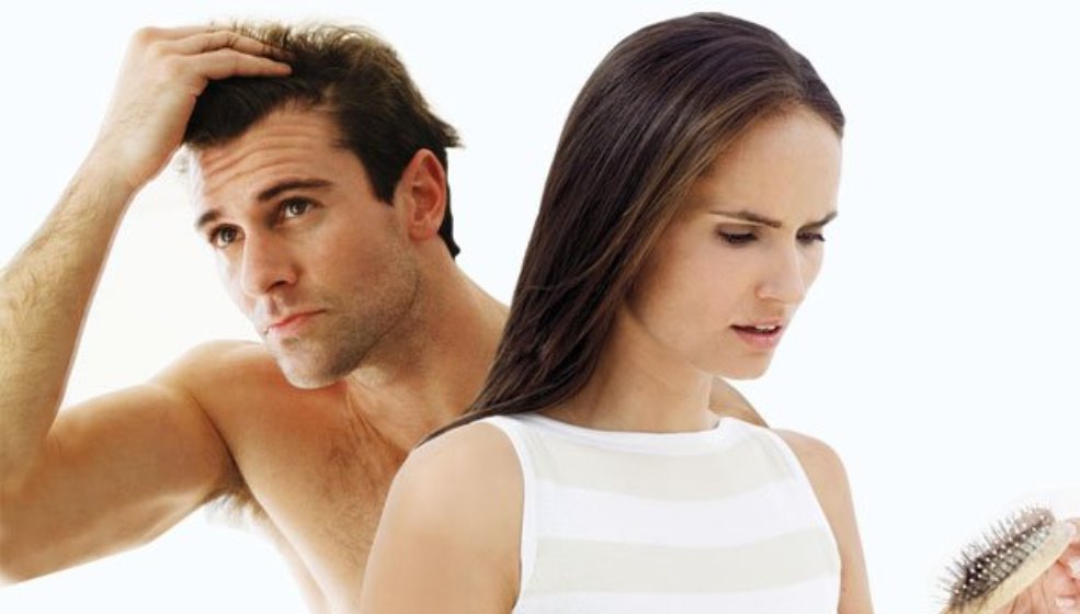 man women losing hair